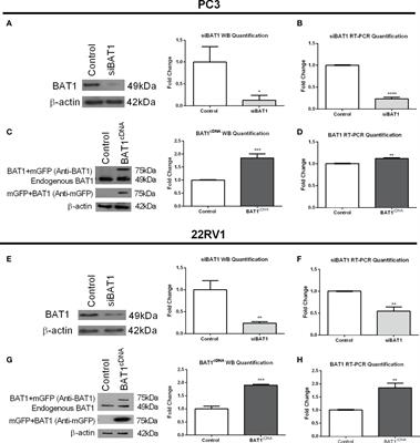 HLA-BAT1 alters migration, invasion and pro-inflammatory cytokines in prostate cancer